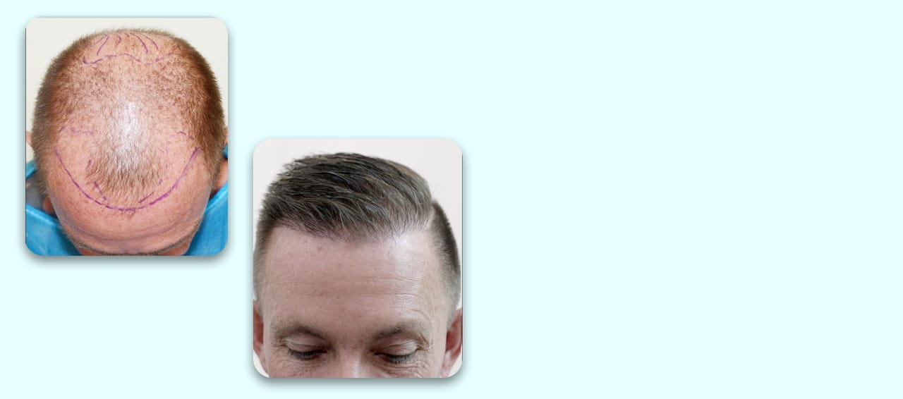 primeira imagem do carrosel