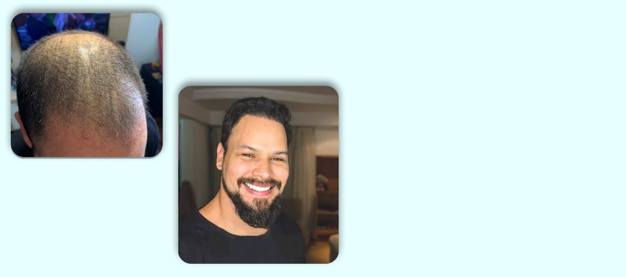 segunda imagem do carrosel