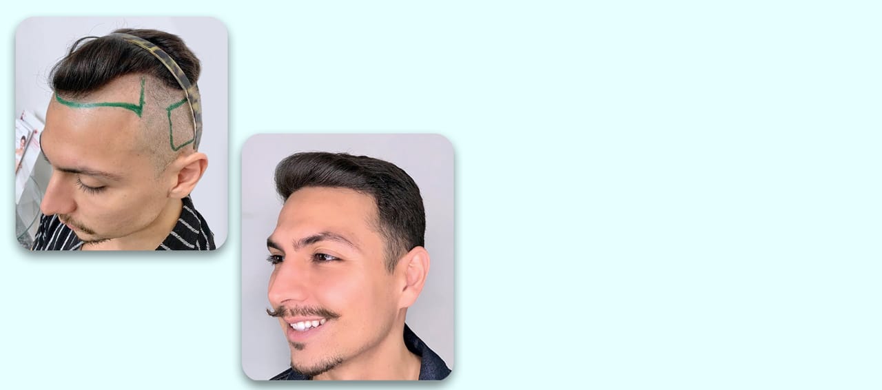 terceira imagem do carrosel