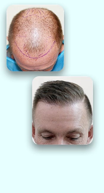 primeira imagem do carrosel