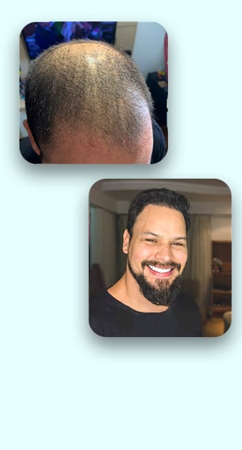 segunda imagem do carrosel