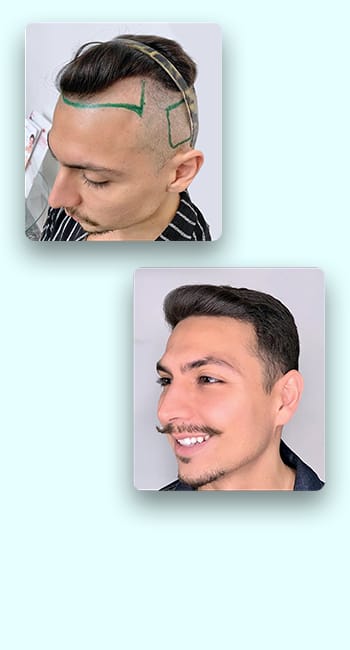 terceira imagem do carrosel